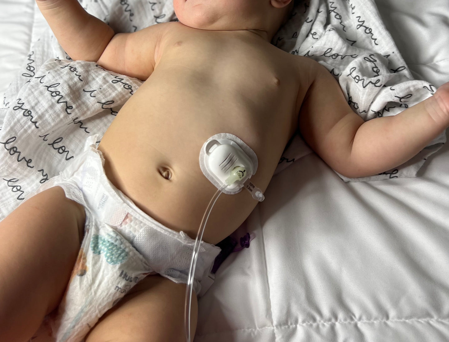 The Button Huggie® Kit