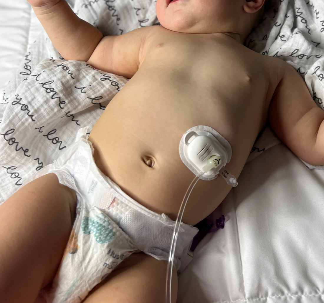 The Ins & Outs of Applying The Button Huggie