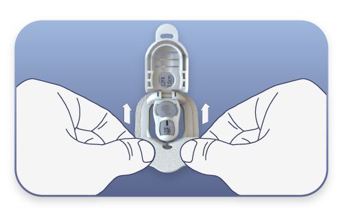 hands sliding new gauze pad into Button Huggie g-button securement device