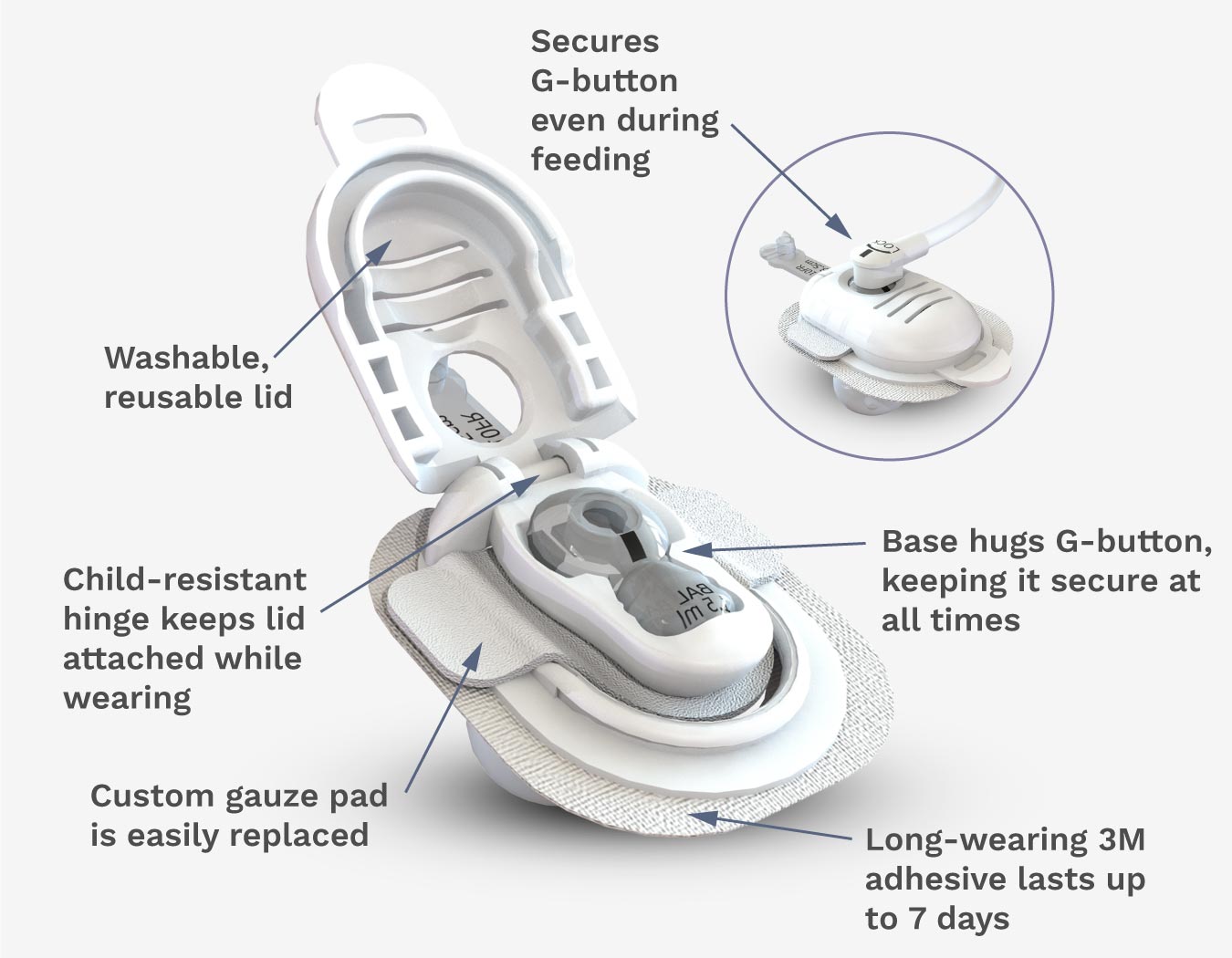 highlighted features of Button Huggie g-button securement device